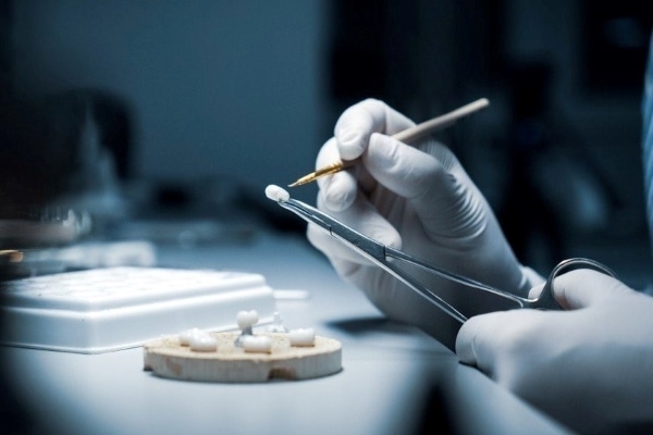 Chế tác răng sứ là bước quan trọng nhất trong quy trình bọc răng sứ thẩm mỹ